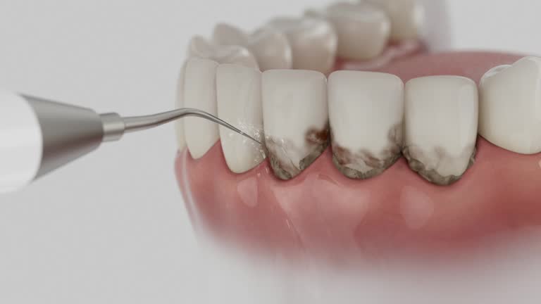 Reliable Emergency Dentist contractor in Cedar Ridge, CA by Smile Center Dentistry